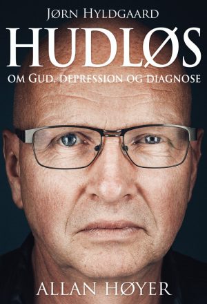 Hudløs - Allan Høyer - Bog