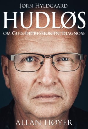Hudløs (E-bog)