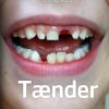Tænder (E-bog)