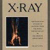 X-RAY (Bog)