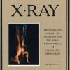 X-ray - Per Morten Abrahamsen - Bog